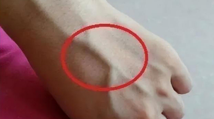 有人手臂上“青筋暴起”，有人卻看不到“青筋”，這是咋回事？