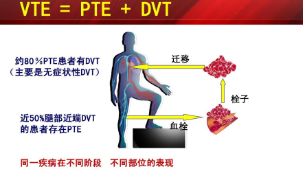 什么是臨床上一致公認(rèn)的VTE防治基礎(chǔ)？